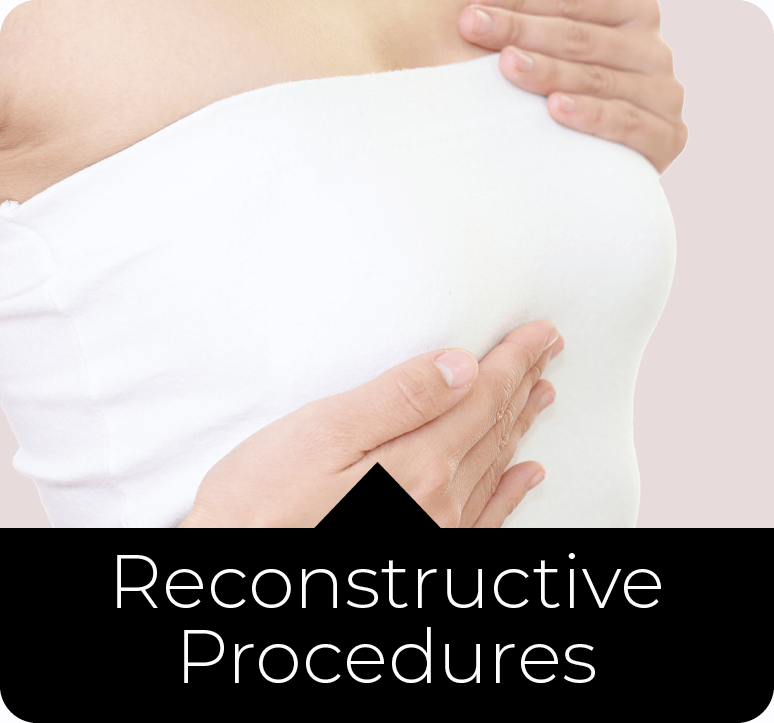 Reconstructive Procedures